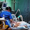 Auf der Intensivstation des Medizin Campus Bodensee werden aktuell drei Corona-Patienten beatmet. Die Sorge ist groß, dass die Zahlen ...