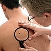 Das Hautscreening steht an? Einige Hautärzte vergeben dafür gar keine Termine mehr an Kassenpatienten. Lediglich Privatpatienten kommen ...