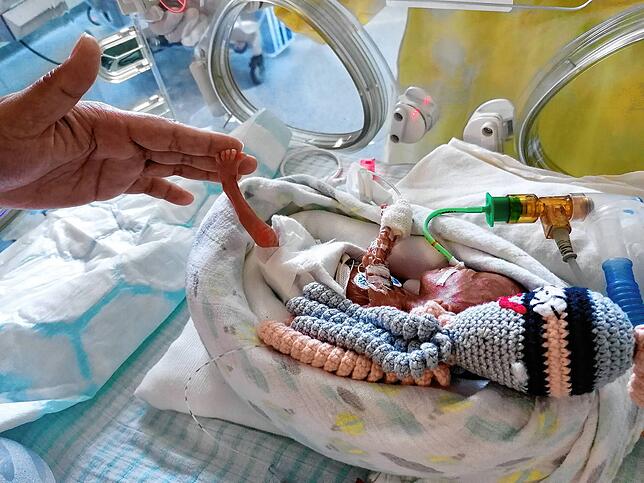 Mireille Kuitert ist ein kleines Wunder, denn sie kam mit nur 272 Gramm im Singener Hegau-Bodensee-Klinikum zur Welt. Die Eltern haben ...