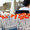 Im MVZ Labor Ravensburg werden wöchentlich aktuell rund 35.000 Proben per PCR-Diagnose auf das Coronavirus untersucht. Damit sind die ...