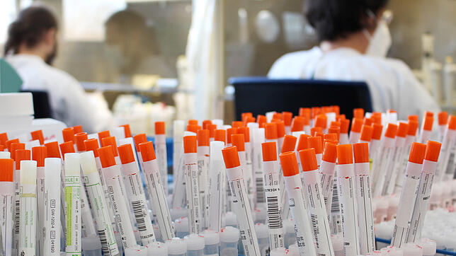 Im MVZ Labor Ravensburg werden wöchentlich aktuell rund 35.000 Proben per PCR-Diagnose auf das Coronavirus untersucht. Damit sind die ...