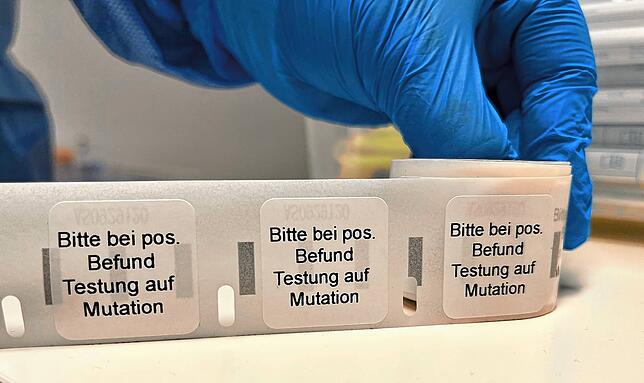 Mit diesen Aufklebern versehen gehen die Proben ins Labor.