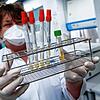 Eine Mitarbeiterin am Institut für Virologie der technischen Universität München (TUM) bereitet Proben von Menschen mit ...