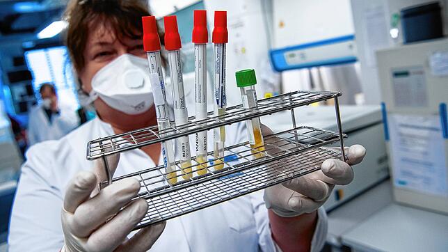 Eine Mitarbeiterin am Institut für Virologie der technischen Universität München (TUM) bereitet Proben von Menschen mit ...