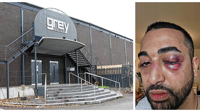 Amir L. fürchtete um sein Leben, als er im Konstanzer Club Grey verprügelt wurde. Nach der Nacht musste er sich einer Operation an ...