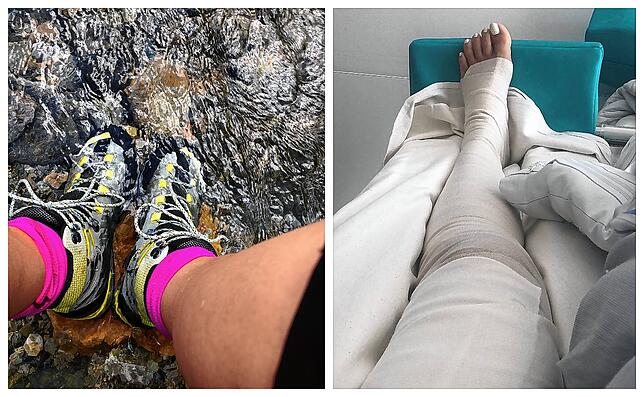 Links im Bild die Füße von Grit K. beim Wandern vor ihrem schweren Radunfall, rechts danach.