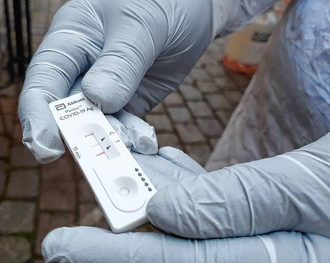 Zwei Streifen – so würde ein positives Testergebnis aussehen. Das Testergebnis wurde durch nicht-infektiöses Material simuliert.