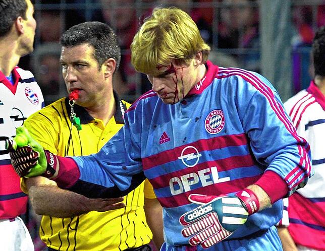 Ein verletzter Bayern-Torhüter Oliver Kahn, nachdem ihn ein Golfball getroffen hatte.