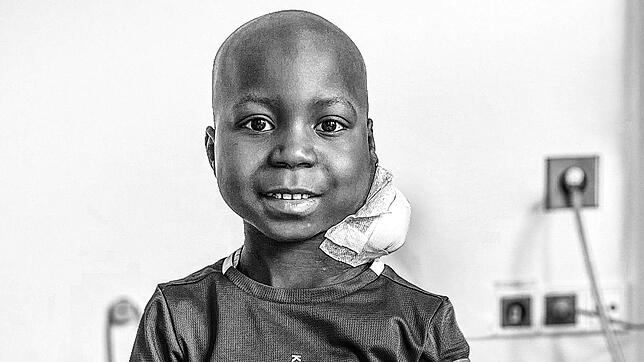 Der kleine Daniel aus Kamerun ist gestorben. Der Krebs hat ihn besiegt. Das Archivbild zeigt ihn während seiner Therapie an der ...