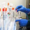 Tests auf das Sars-CoV-2-Virus in einem Labor (Symbolbild)