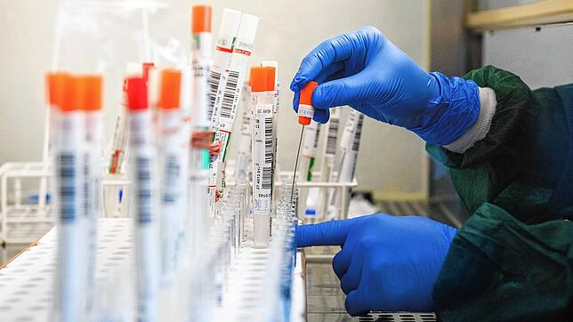 Tests auf das Sars-CoV-2-Virus in einem Labor (Symbolbild)