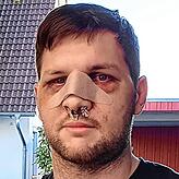 Am Donnerstag durfte Marco Boxler das Krankenhaus verlassen. Nun erholt er sich von der Operation.