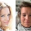 Katharina Kuhlmann vor ihrem Schlaganfall (links) und direkt danach &ndash; das Foto ist ein Selfie aus dem Krankenhaus.