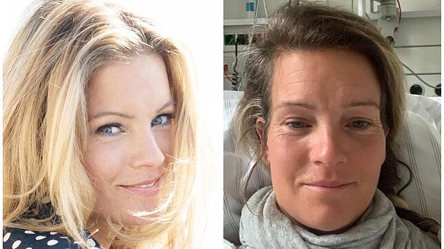 Katharina Kuhlmann vor ihrem Schlaganfall (links) und direkt danach &ndash; das Foto ist ein Selfie aus dem Krankenhaus.