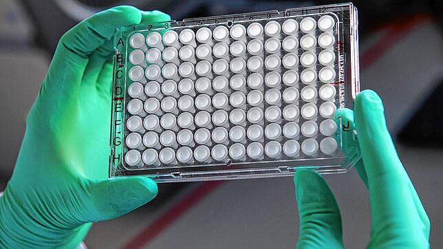 23.03.2020, Bayern, München: Eine Mitarbeiterin am Institut für Virologie der technischen Universität München (TUM) hält eine ...