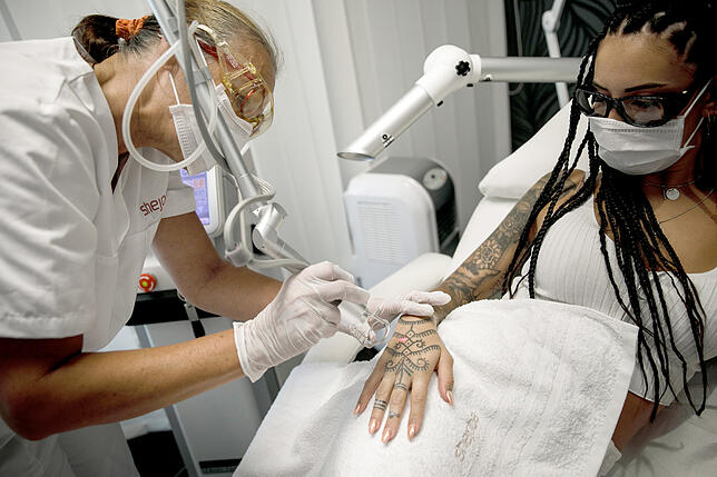 Eine Heilpraktikerin entfernt mit einer Laserbehandlung ein Tattoo auf der Hand von Erzieherin Vanessa Stark.