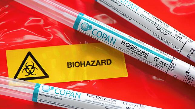 Mehrere Abstrichstäbchen im Plastikröhrchen liegt in der Infektions-Ambulanz eines Krankenhauses auf einer Schutztüte mit der Aufschrift ...
