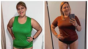 Ein Vergleich: Links ist Rebecca Schuler vor ihrer Liposuktion, rechts danach. Ihr wurden zehn Kilo Fett abgesaugt.
