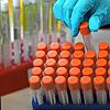 Im Schwarzwald-Baar-Kreis ist ein weiterer Mensch an den Folgen des Coronavirus gestorben, jetzt liegt die Zahl der Todesopfer bei 39.