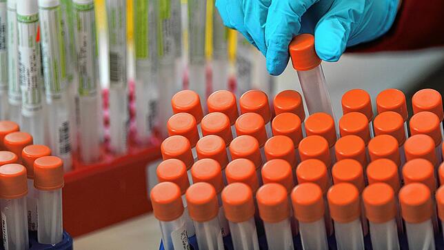 Im Schwarzwald-Baar-Kreis ist ein weiterer Mensch an den Folgen des Coronavirus gestorben, jetzt liegt die Zahl der Todesopfer bei 39.