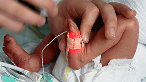 ARCHIV – Wenn Kliniken frühgeborene Kinder versorgen möchten, müssen sie eine Mindestanzahl von Patienten aufweisen. Dagegen haben drei ...