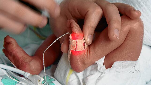 ARCHIV – Wenn Kliniken frühgeborene Kinder versorgen möchten, müssen sie eine Mindestanzahl von Patienten aufweisen. Dagegen haben drei ...