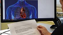 Auch am Klinikum Friedrichshafen läuft eine klinische Studie, die eine kleine Herzpumpe an Patienten testet.