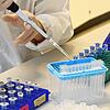Analyse eines Abstrichs auf Sars-CoV-2 im Labor.