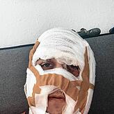 Robin Schellinger mit einem von vielen Gesichtsverbänden – noch vor der Operation.