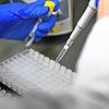 Eine Mitarbeiterin in einem Testlabor bereitet PCR-Tests vor. (Symbolbild).