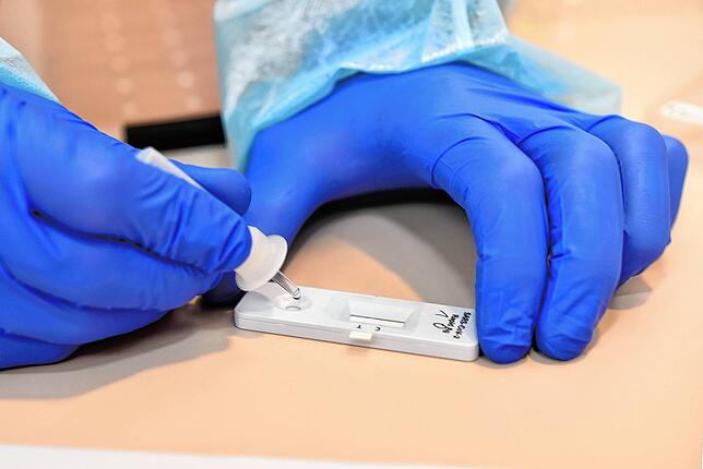 Die Probe wird auf den Teststreifen aufgetröpfelt.