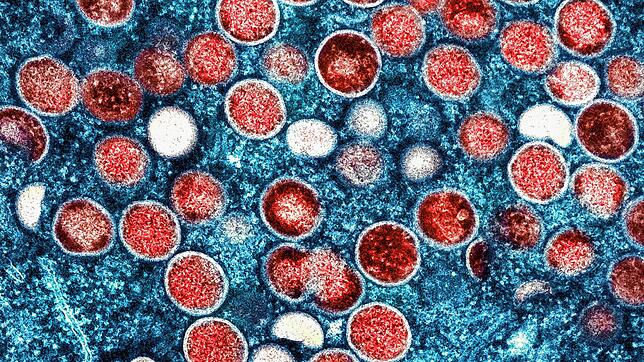 Eine in Afrika zirkulierende Variante des Mpox-Virus ist nun auch erstmals in Europa nachgewiesen worden.